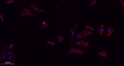TGFβ1 rabbit pAb