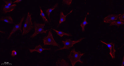 TNF-α rabbit pAb