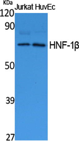 HNF-1β rabbit pAb