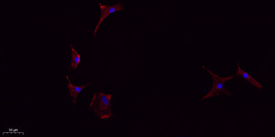 IL-1β rabbit pAb