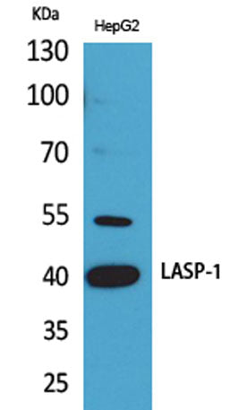 LASP-1 rabbit pAb