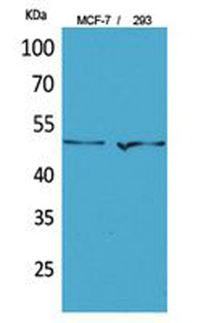 PD-ECGF rabbit pAb