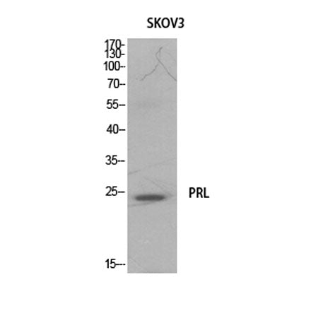 Prolactin rabbit pAb