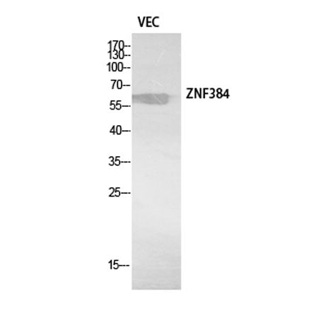 ZNF384 rabbit pAb
