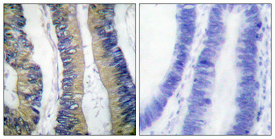 4E-BP1 (phospho Thr69) rabbit pAb