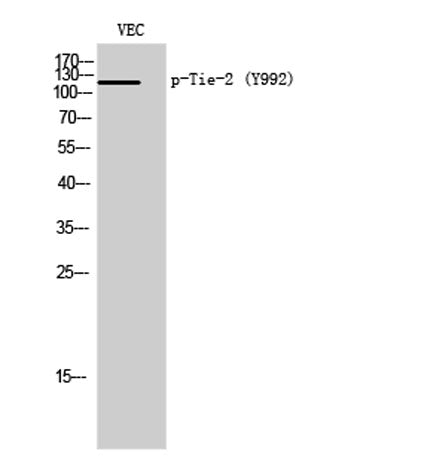 Tie-2 (phospho Tyr992) rabbit pAb