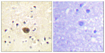 Ras-GRF1 rabbit pAb