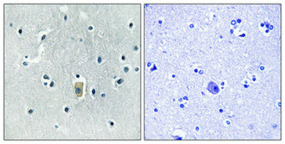 Bim (phospho Ser59) rabbit pAb