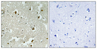 p27 (phospho Ser178) rabbit pAb