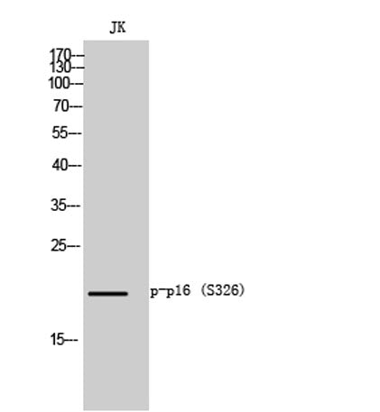 p16-INK4a (Phospho-Ser152) rabbit pAb