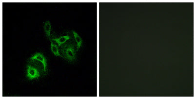 ACSVL4 rabbit pAb