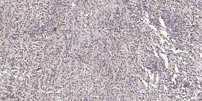SCG10 (phospho Ser73) rabbit pAb