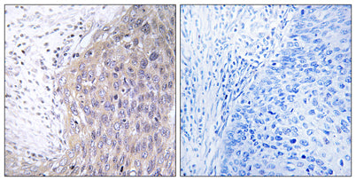 DNA pol γ2 rabbit pAb