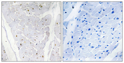 Alpha-protein Kinase 2 rabbit pAb