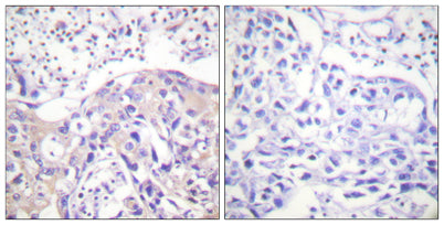Adducin α (phospho Thr445) rabbit pAb