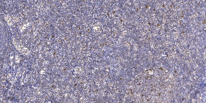 JDP2 (phospho Thr148) rabbit pAb