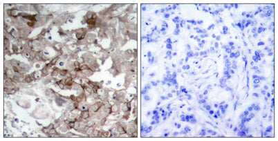Cortactin rabbit pAb