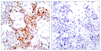 ATF-2 (phospho Thr69) rabbit pAb