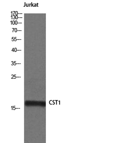 Cystatin SN rabbit pAb