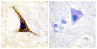 AR-β2 (phospho Ser355/S356) rabbit pAb