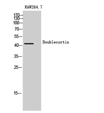 Doublecortin rabbit pAb