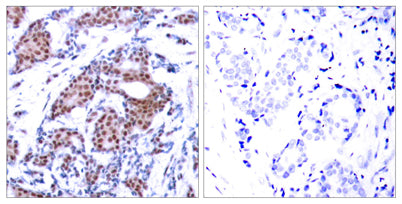 Elk-1 (phospho Ser383) rabbit pAb