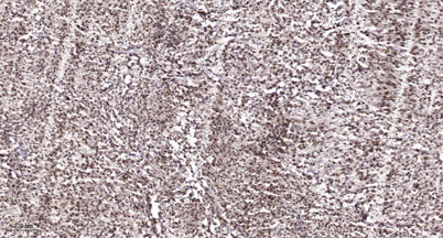 CSB rabbit pAb