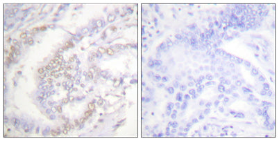 FANCD2 (phospho Ser222) rabbit pAb