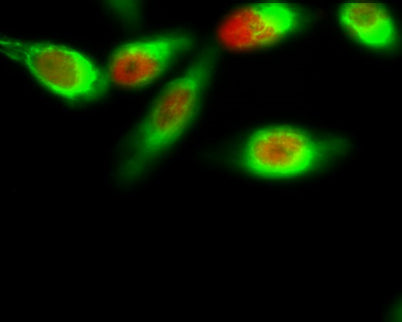 FoxO1 (phospho Ser256) rabbit pAb