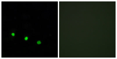 Fos B (phospho Ser27) rabbit pAb