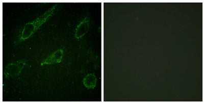 c-Abl (phospho Tyr245) rabbit pAb