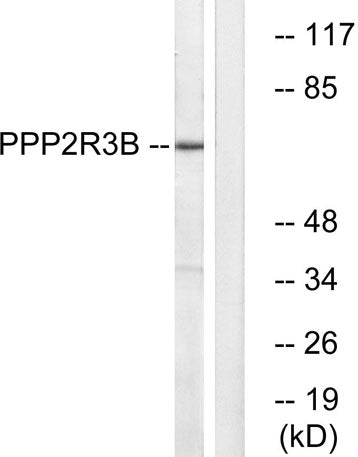 PR48 rabbit pAb