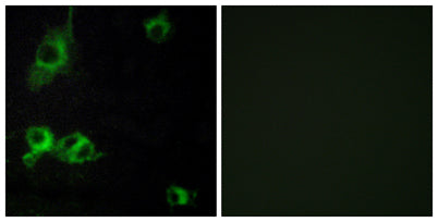 Laminin α-1 rabbit pAb