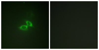NMDAζ1 rabbit pAb