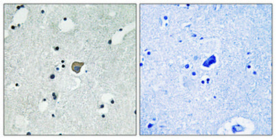 NMDAε1/2 (phospho Tyr1246/1252) rabbit pAb