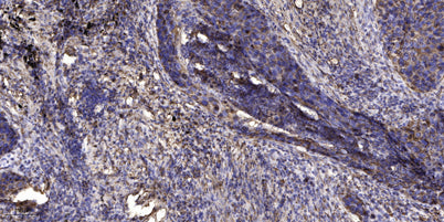 Lck BP-1 (phospho Tyr378) rabbit pAb