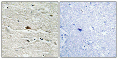HMG-14 (phospho Ser21) rabbit pAb