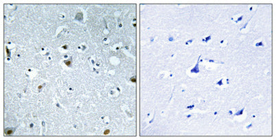 HMG-17 (phospho Ser29) rabbit pAb