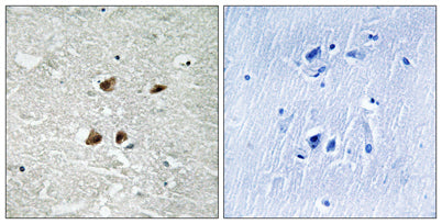 HSF1 (phospho Ser121) rabbit pAb