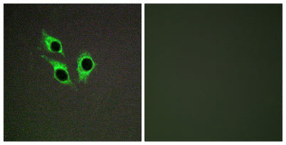 Anoctamin-9 rabbit pAb