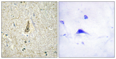 CYP26C1 rabbit pAb