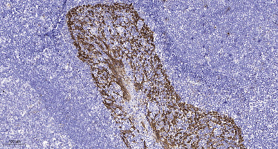 Kv4.2 (phospho Ser616) rabbit pAb