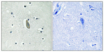 c-Kit (phospho Tyr936) rabbit pAb