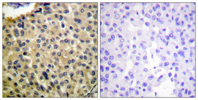 c-Kit (phospho Tyr703) rabbit pAb