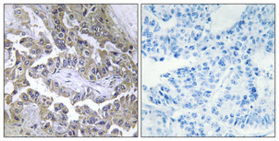 Laminin β-2 rabbit pAb