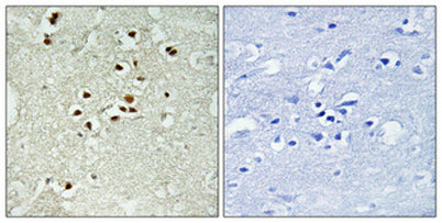 DNA Ligase IV (phospho Thr650) rabbit pAb