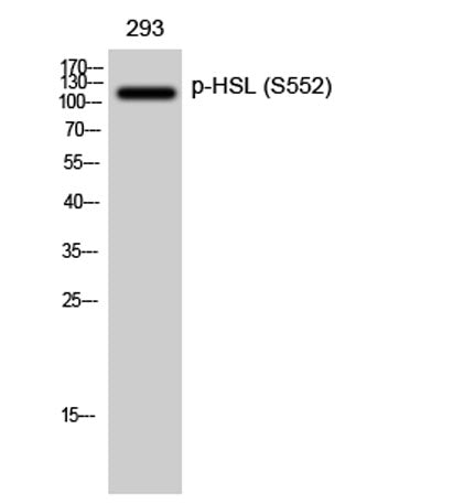 HSL (phospho Ser552) rabbit pAb