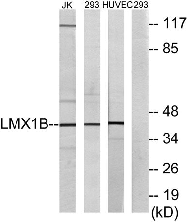 LMX1B rabbit pAb
