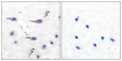 MARCKS (phospho Ser163) rabbit pAb