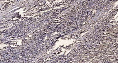 Smad2 (phospho Ser465) rabbit pAb